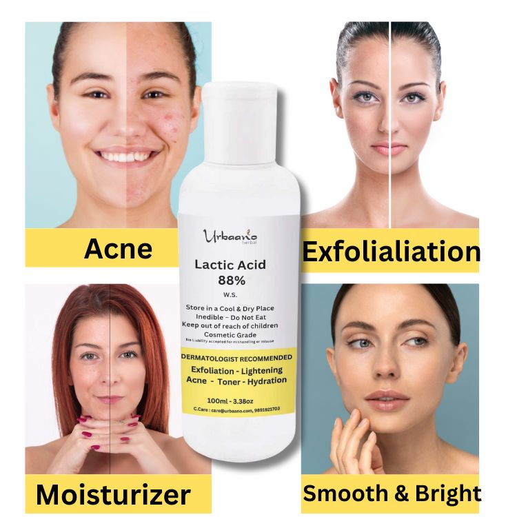 Lactic Acid 88% (AHA Exfoliant) for making DIY Skincare Face Toner, Serum, Soap, Lotion & Cream