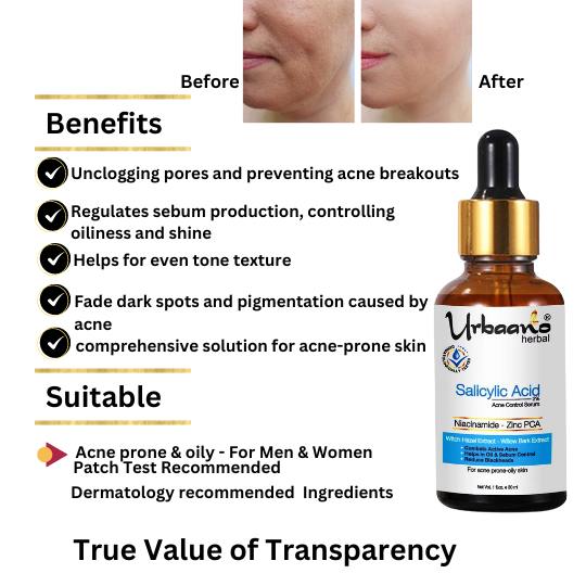 Salicylic acid 2% Face Serum, Niacinamide & Zinc PCA for Skin Brightening, Control Pimple, Acne