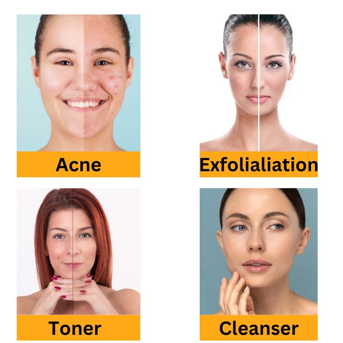Glycolic Acid 70% (AHA Exfoliant) for Making Cleansers, Toner, Creams, Masks