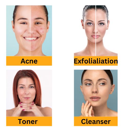 Glycolic Acid 70%, Anti Acne (AHA Exfoliant) for Cleansers, Toner, Creams, Masks Making