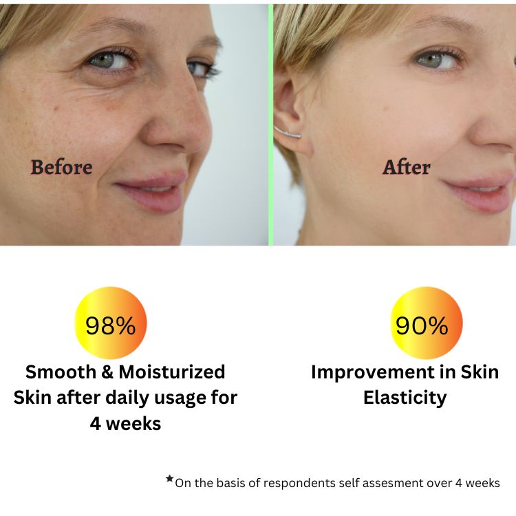 Sugarcane Squalane 100% (Plant Derived) Super-Lightweight Face Oil | Improves Skin Hydration, Elasticity, Moisturize & Reduces Fine Lines